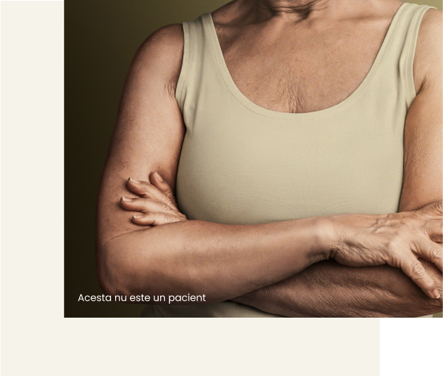 Real life image of an older woman's crossed arms
